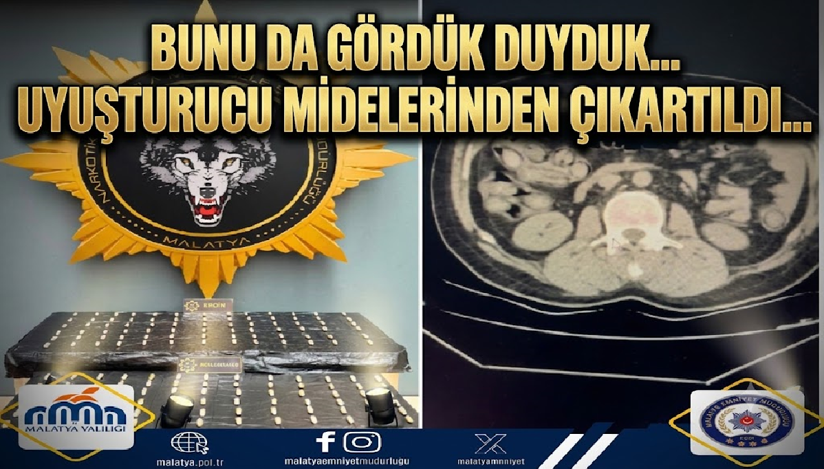 Türk polisinden kaçmaz…2 yabancı uyruklunun midesinde uyuşturucu çıkartıldı Ali Aladağ…:Malatya Olay Haber…:
Son dakika…Sıcak haber…Bunu da duyduk ve gördük…2